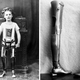 Illustration for article titled A Century-Old Prosthesis So Advanced Even an Expert Thought It Was Fake
